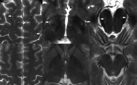 FIG 2.