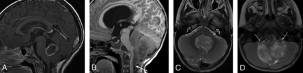 FIG 2.