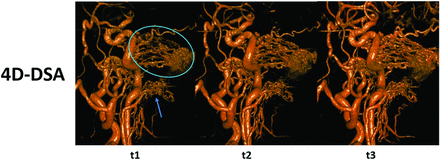 FIG 3.