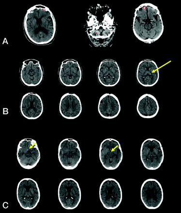 FIG 2.