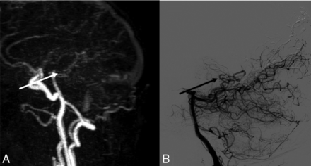 FIG 2.