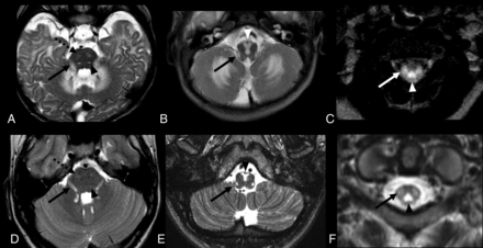 FIG 5.
