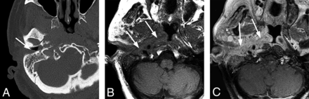 FIG 5.
