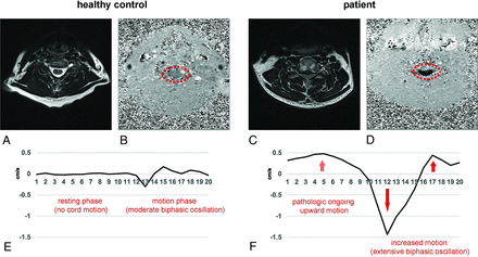 FIG 6.