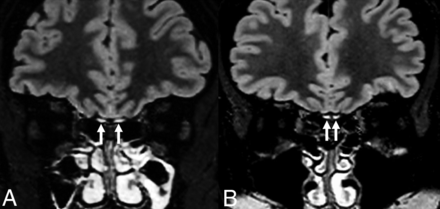 FIG 1.
