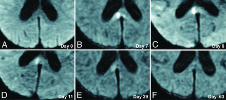 FIG 2.