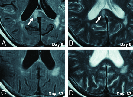 FIG 3.