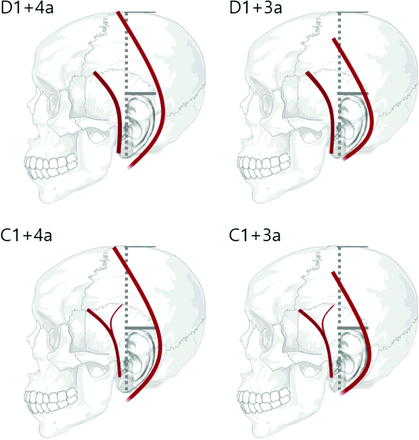FIG 3.