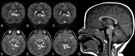 FIG 2.