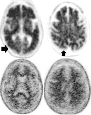 FIG 2.