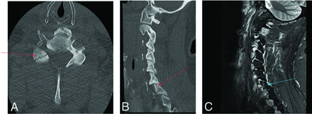 FIG 6.