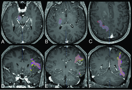 FIG 3.