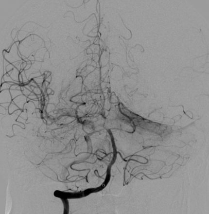 FIG 3.