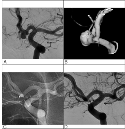 FIG 3.