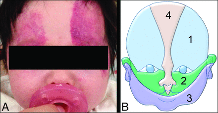 FIG 1.