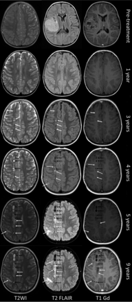 FIG 2.