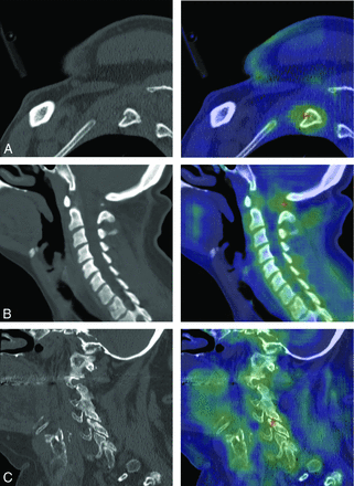 FIG 3.
