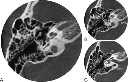 Fig 1.
