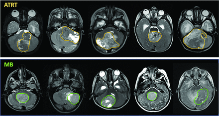 FIG 3.