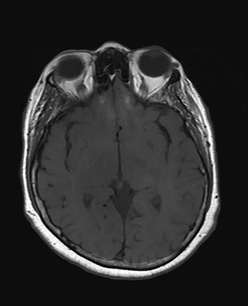 FIG 1.