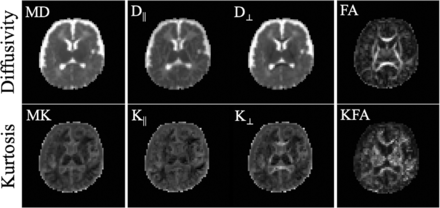 FIG 1.