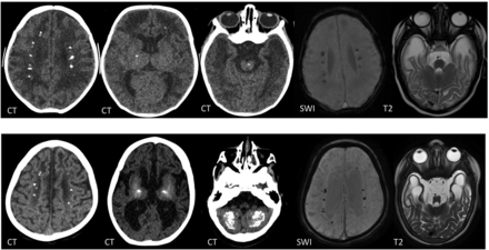 FIG 3.