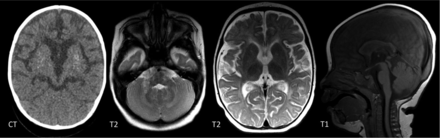 FIG 4.