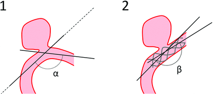 FIG 1.