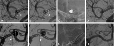 FIG 3.