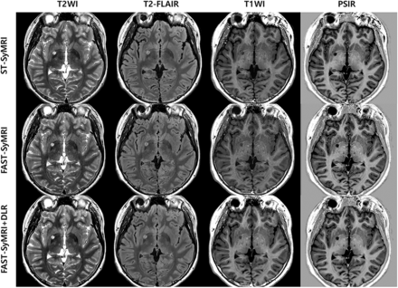 FIG 1.