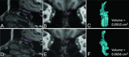 FIG 1.