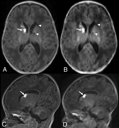 FIG 1.