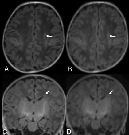 FIG 3.