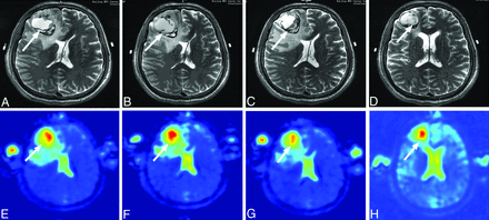 FIG 4.