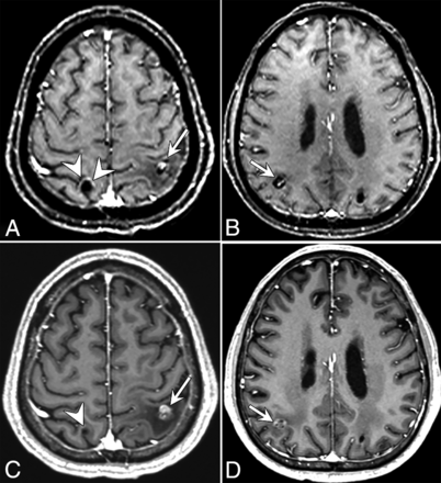 FIG 1.