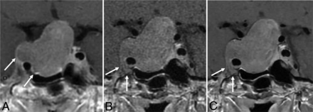 FIG 2.