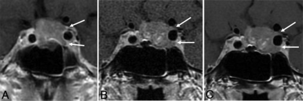 FIG 3.