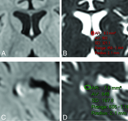 FIG 4.