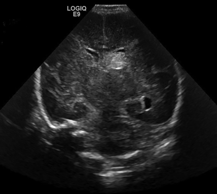 FIG 1.