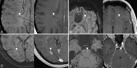 FIG 2.