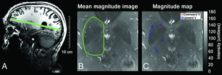 FIG 1.