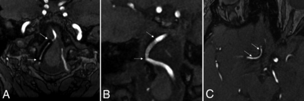 FIG 3.