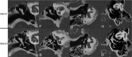 FIG 3.