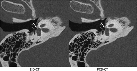 FIG 6.