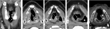 FIG 1.