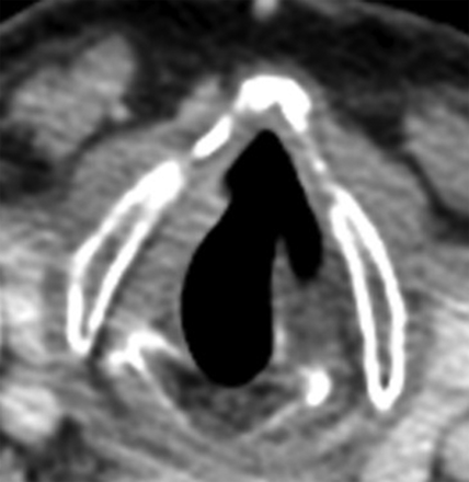 FIG 2.
