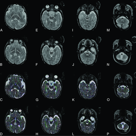 FIG 1.