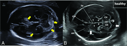 FIG 1.