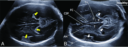 FIG 2.