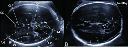 FIG 3.